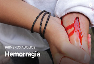 hemorragias