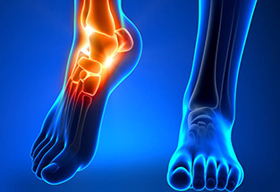 lesiones osteoarticulares